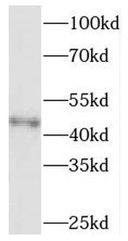 SOAT2 Rabbit Polyclonal Antibody
