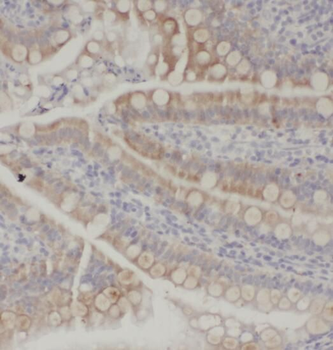 SOAT2 Rabbit Polyclonal Antibody