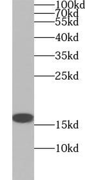 SOD1 Antibody