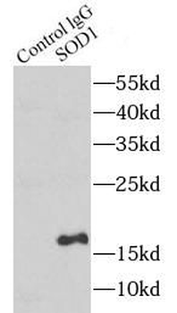 SOD1 Antibody