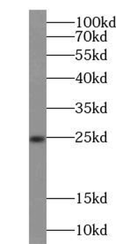 SOD2 Antibody