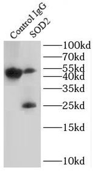 SOD2 Antibody