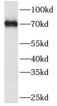 SESTD1 Rabbit Polyclonal Antibody