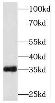 SESTD1 Rabbit Polyclonal Antibody