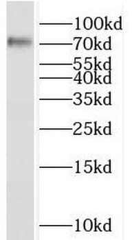 SORCS1 Rabbit Polyclonal Antibody