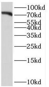 SORCS1 Rabbit Polyclonal Antibody