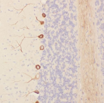 SORCS1 Rabbit Polyclonal Antibody