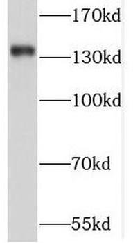 SORCS2 Rabbit Polyclonal Antibody