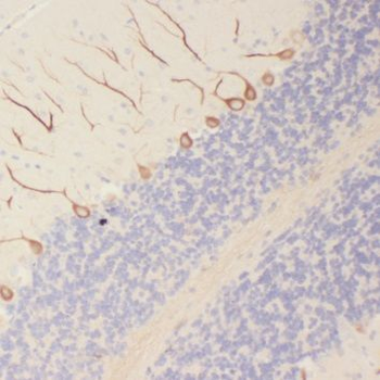 SORL1 Antibody