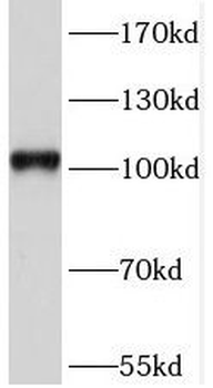 SORT1 Antibody