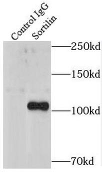 SORT1 Antibody