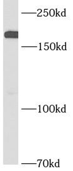 SOS1 Rabbit Polyclonal Antibody