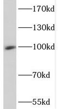 SP100 Rabbit Polyclonal Antibody