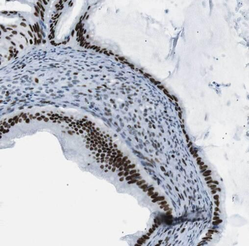 SP100 Rabbit Polyclonal Antibody