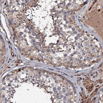 SPA17 Rabbit Polyclonal Antibody