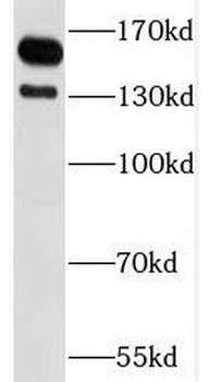 SPAG5 Rabbit Polyclonal Antibody