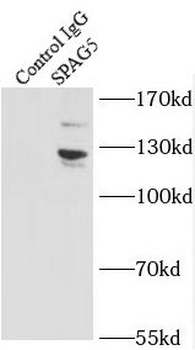 SPAG5 Rabbit Polyclonal Antibody