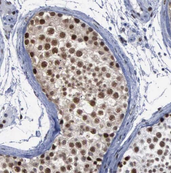 SPAG5 Rabbit Polyclonal Antibody