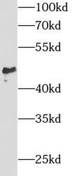SPAM1 Rabbit Polyclonal Antibody