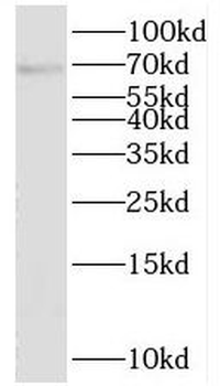 SPHK2 Rabbit Polyclonal Antibody
