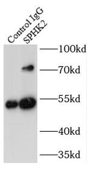 SPHK2 Rabbit Polyclonal Antibody