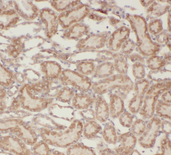 SPHK2 Rabbit Polyclonal Antibody