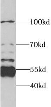 SPTLC1 Rabbit Polyclonal Antibody