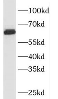 SQLE Rabbit Polyclonal Antibody