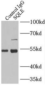 SQLE Rabbit Polyclonal Antibody