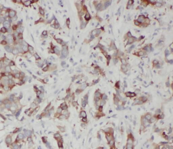SQLE Rabbit Polyclonal Antibody