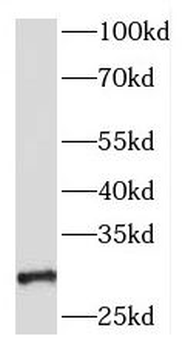 SRD5A1 Antibody