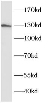 SRGAP1 Rabbit Polyclonal Antibody