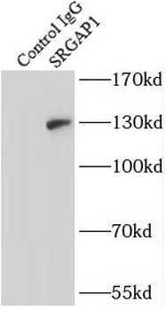 SRGAP1 Rabbit Polyclonal Antibody