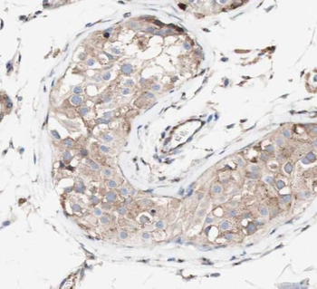 SRGAP1 Rabbit Polyclonal Antibody