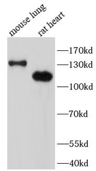 SRGAP2 Rabbit Polyclonal Antibody