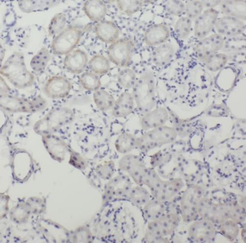 SRGAP2 Rabbit Polyclonal Antibody