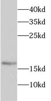 SRP19 Rabbit Polyclonal Antibody