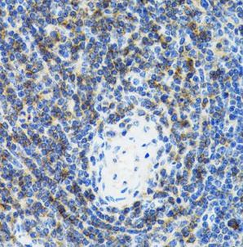 SRP19 Rabbit Polyclonal Antibody