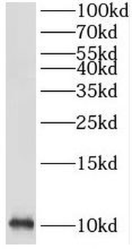SRP9 Rabbit Polyclonal Antibody