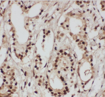 SRP9 Rabbit Polyclonal Antibody