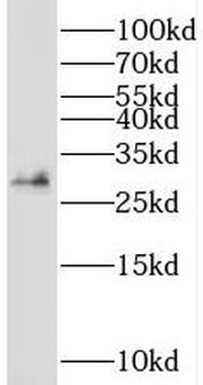 SRPRB Rabbit Polyclonal Antibody