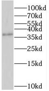SRR Rabbit Polyclonal Antibody