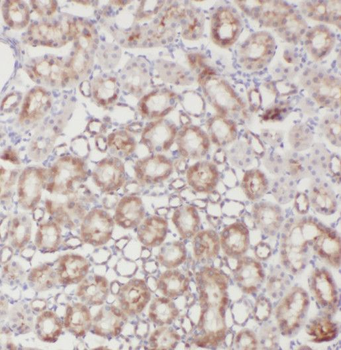 SRR Rabbit Polyclonal Antibody