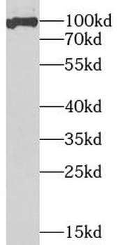 SSRP1 Rabbit Polyclonal Antibody