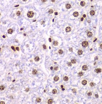 SSRP1 Rabbit Polyclonal Antibody