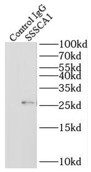 ZNRD2 Rabbit Polyclonal Antibody