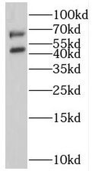 SSTR5 Rabbit Polyclonal Antibody