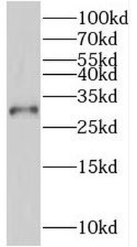 SSU72 Rabbit Polyclonal Antibody