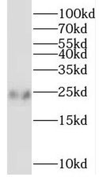 SSX1 Rabbit Polyclonal Antibody