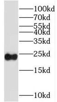 SSX4 Rabbit Polyclonal Antibody